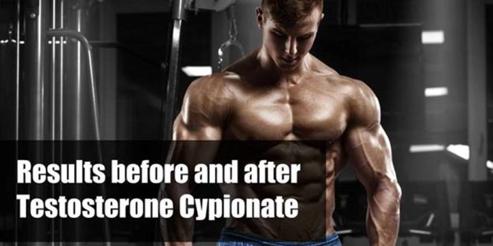 Results of Testosterone Cypionate Before and After Steroid Cycle